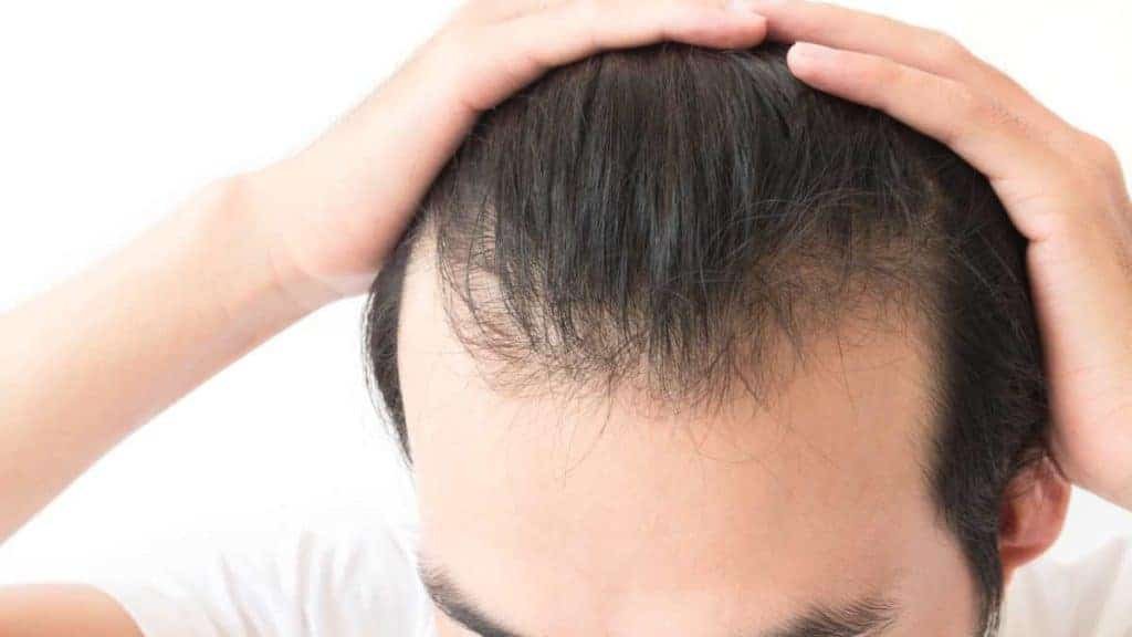 7 Benefits Of Hair Thickening Powder For Balding Men Too Manly